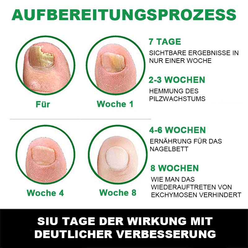Nagelpflege Mit Ingwer