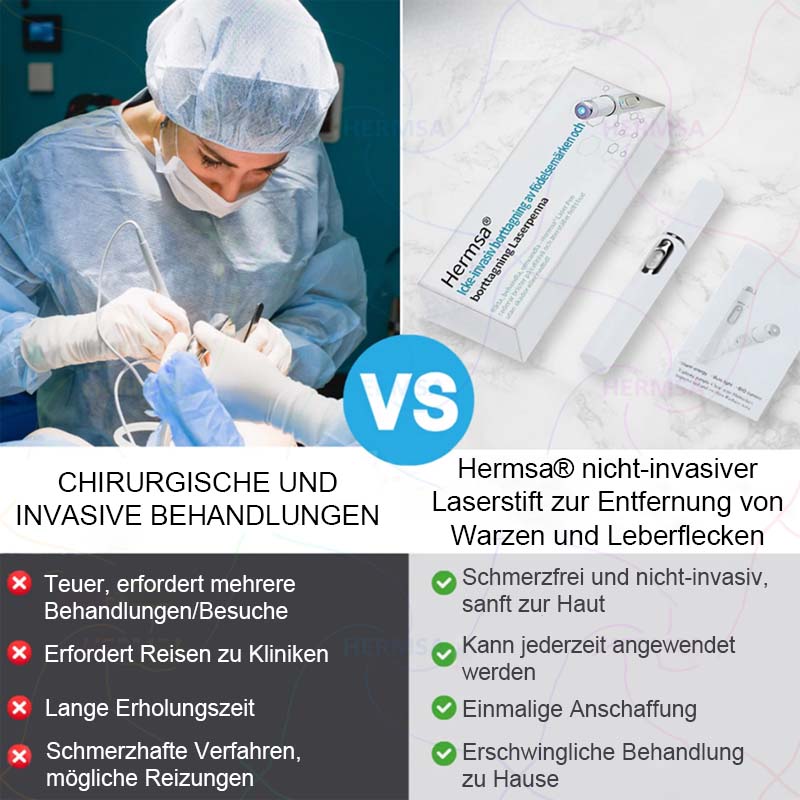 nicht-invasiver Laserpointer - Muttermal- und Warzenentfernung (🔥Letzter Tag 80% Rabatt)