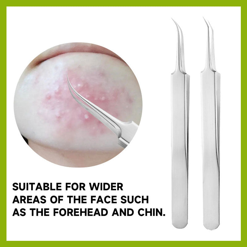 Stainless Steel Acne Clip