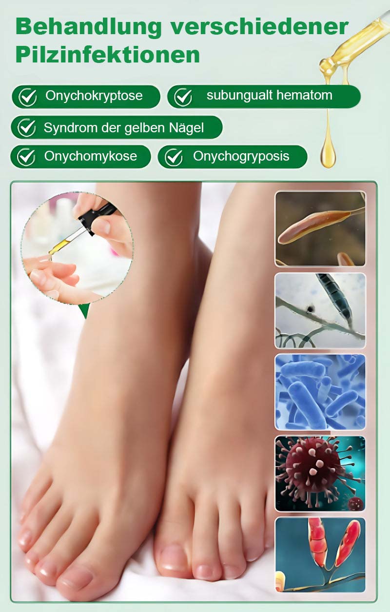 Nagelpflege Mit Ingwer