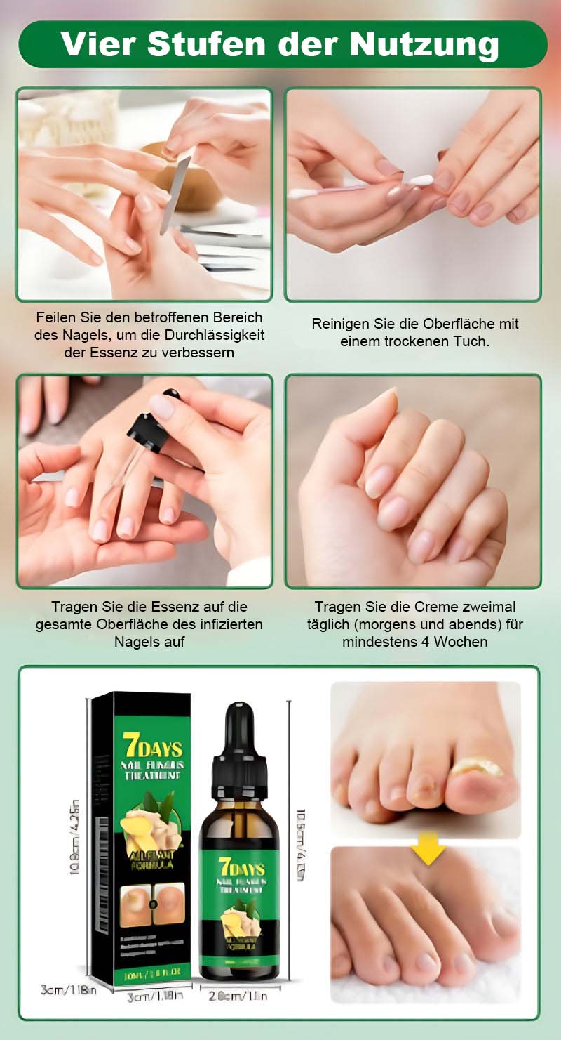 Nagelpflege Mit Ingwer