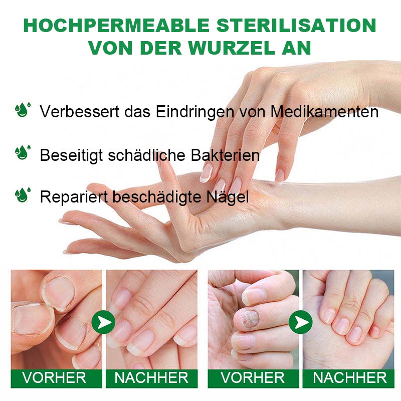 Nagelpflege Mit Ingwer