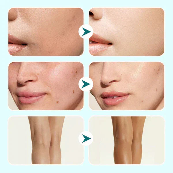 🔥Letzter Tag 1 kaufen und 1 gratis bekommen!🎁All-in-One Feuchtigkeitspflege, Concealer und Abdeckung 💧✨ Leicht und wasserfest