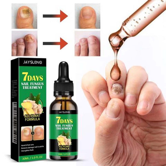 Nagelpflege Mit Ingwer