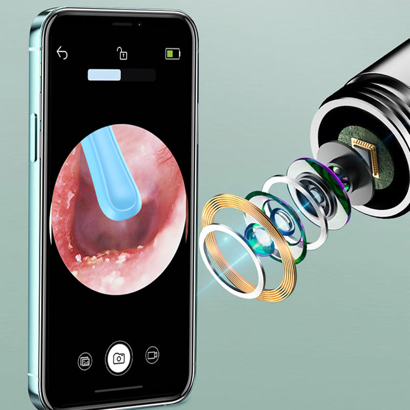 ⏳Begrenzte Zeit 50% Rabatt💥Intelligenter wasserdichter visueller Ohrenschmalzentferner